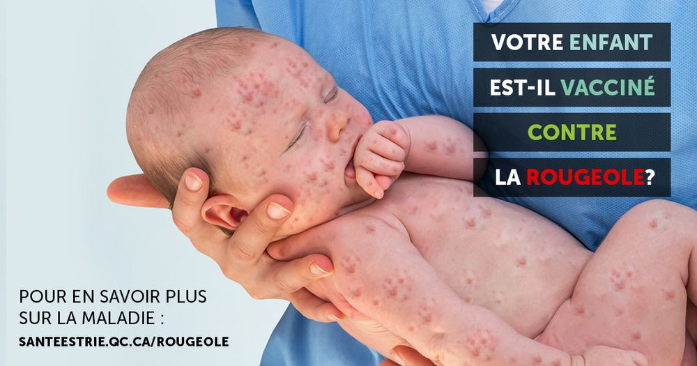 Campagne de vaccination contre la rougeole - CIUSSS de l'Estrie - CHUS